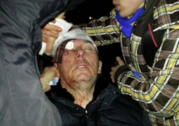 Столкновения в Киеве: экс-глава МВД Украины в реанимации