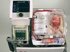 В Австралии впервые сделали пересадку «мертвого сердца»