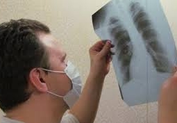 Четверо одноклассников заразились туберкулезом в школе в Актюбинской области