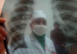 В уральском роддоме у сотрудницы выявлена открытая форма туберкулеза