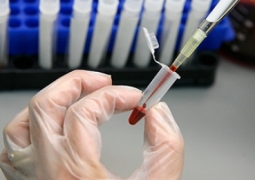 Препарат на основе антител к ВИЧ впервые успешно испытали на людях