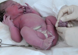 У мертвого новорожденного вырезали органы в России