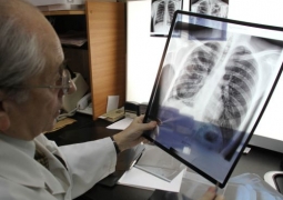 В Казахстане Генпрокуратура разыскивает 70 больных туберкулёзом, уклоняющихся от лечения