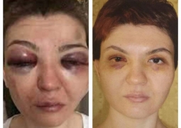 Избивая бывшую супругу, мужчина обещал ей участь Баян Есентаевой
