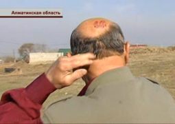 Пенсионер обвинил сельского акима и его сына в избиении в Алматинской области