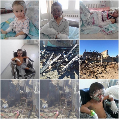 При взрыве газового баллона пострадала семья с детьми в Кызылорде