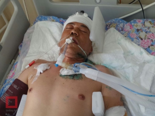 Неизвестный мужчина умер в больнице в Алматы после ДТП