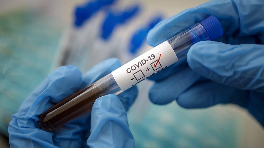 Число зараженных коронавирусом достигло 444 человек в Казахстане