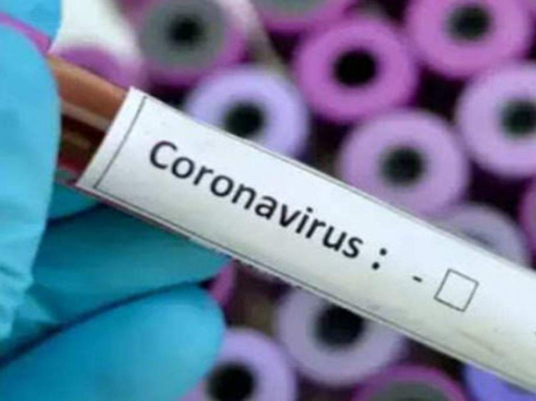 Коронавирус індетін жұқтырған тағы 40 адам тіркелді