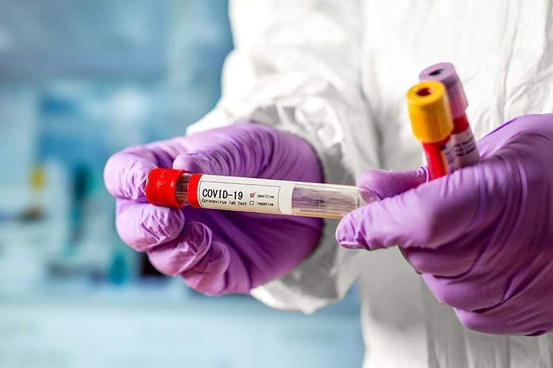 В стране зарегистрировано 2791 случаев заражения коронавирусом 