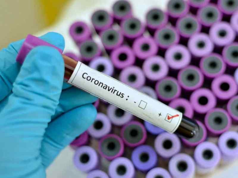 Коронавирус: В стране количество зараженных достигло отметки 2860