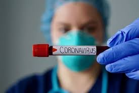 Коронавирус инфекциясын жұқтырған тағы 67 адам тіркелді