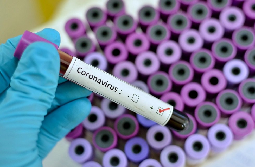 В Казахстане выявлено 988 бессимптомных носителей коронавирусной инфекции