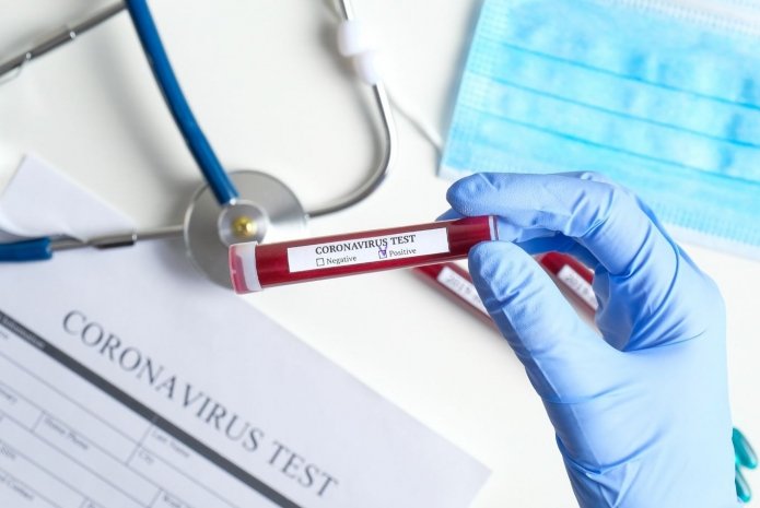 В Казахстане зарегистрировано еще 492 заболевших коронавирусной инфекцией