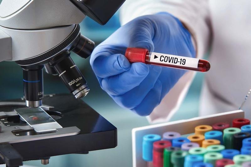 Масштабное исследование на наличие антител к COVID-19 проведут в Казахстане