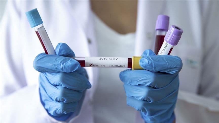 За прошедшие сутки в Казахстане выявлены 1060 заболевших коронавирусной инфекцией