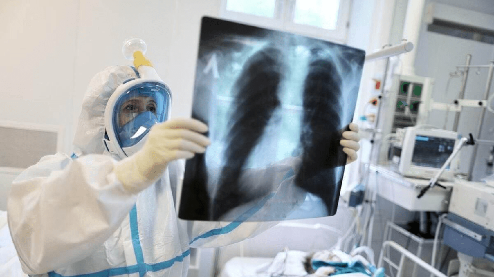 За прошедшие сутки зафиксированы 57 случаев заболевания пневмонией с признаками коронавирусной инфекции