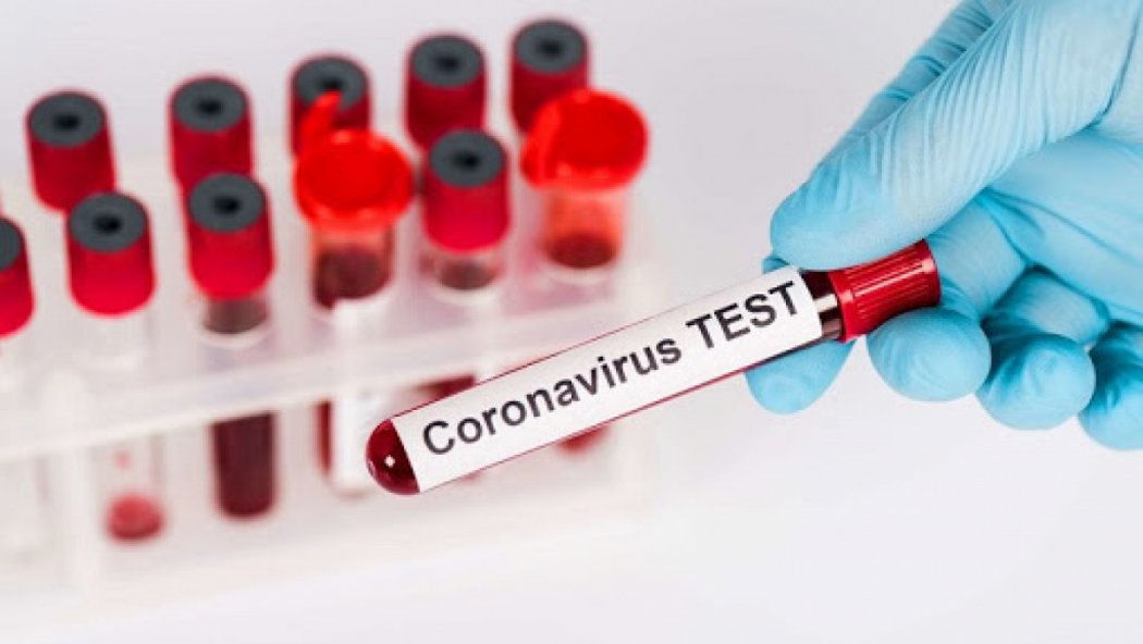 COVID-19: Қазақстанда тағы 691 адам коронавирус жұқтырды