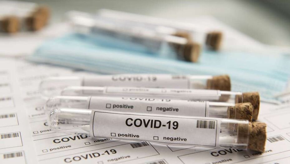 За прошедшие сутки в Казахстане выявлены 244 заболевших коронавирусной инфекцией