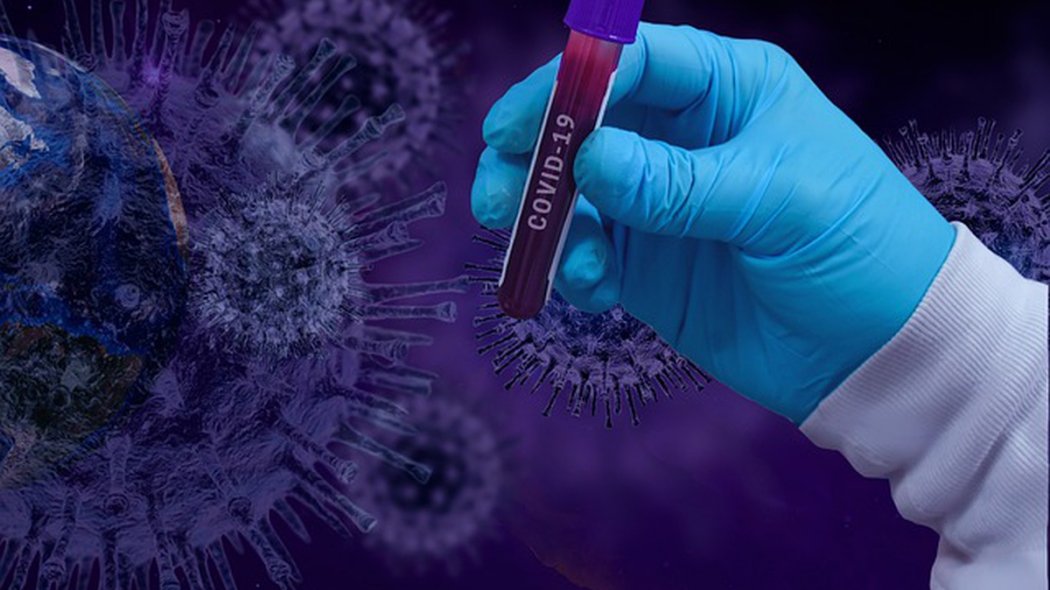 За прошедшие сутки в Казахстане выявлены 76 заболевших коронавирусной инфекцией 