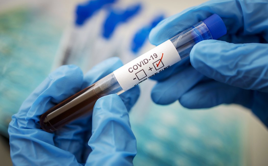75 человек заболели коронавирусом в Казахстане