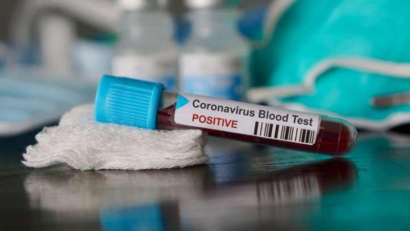 74 адамнан коронавирус індеті анықталған