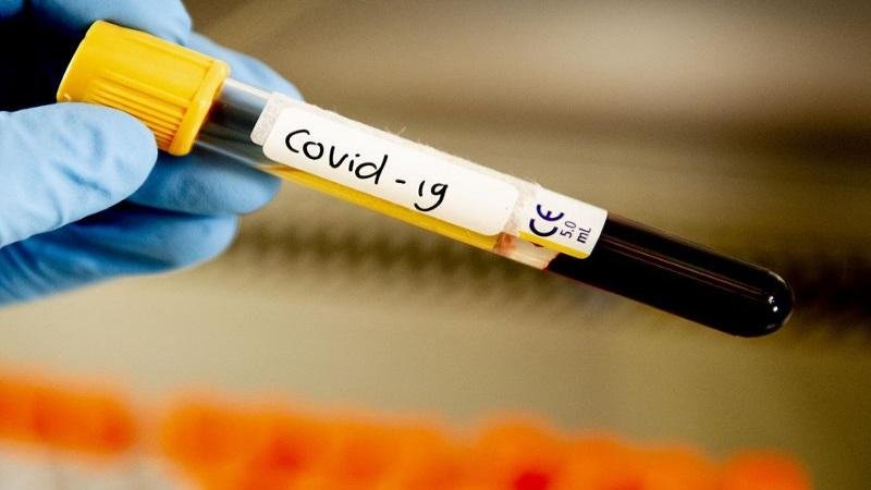 Өткен тәулікте 143 адамнан коронавирус расталды