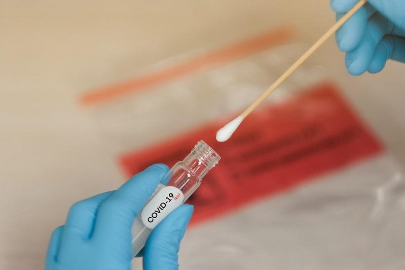 Ошибочные тесты на коронавирус выявили в лаборатории Семея