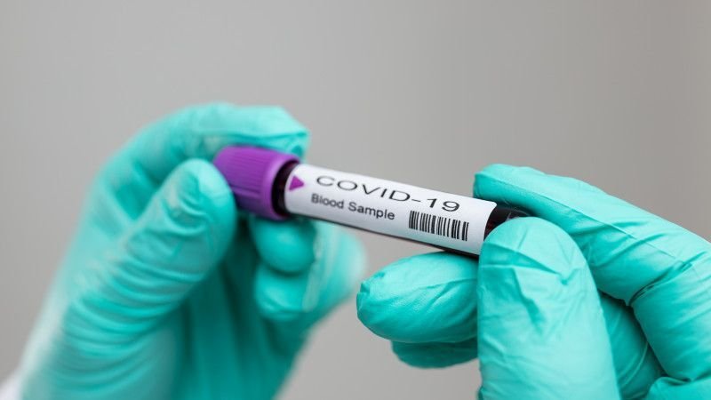 За прошедшие сутки в Казахстане выявлен 791 заболевший COVID-19