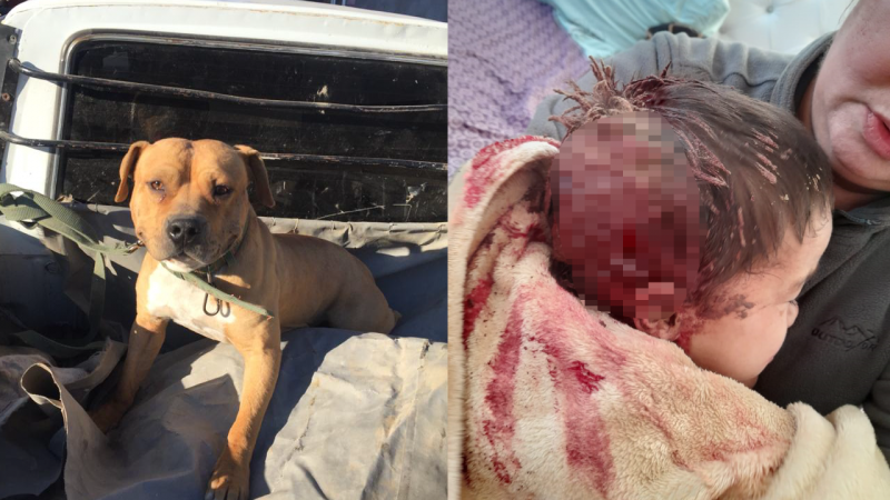 В Атырау собака напала на 2-летнего ребенка 