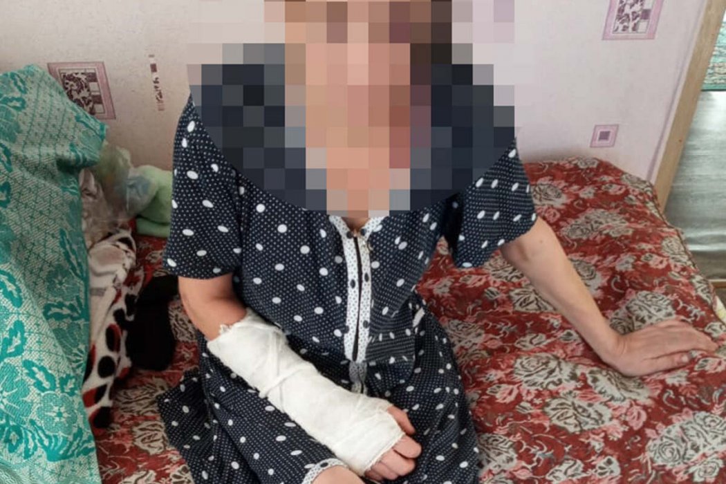 В СКО домашний тиран сломал жене руку и ногу