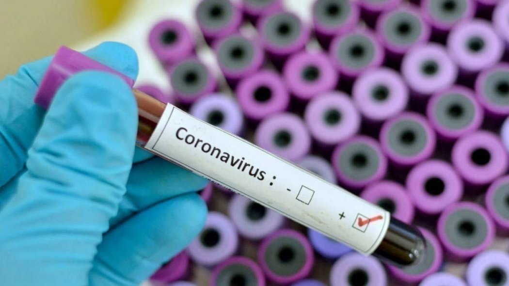 Число заболевших коронавирусом составило 148 708 человек в Казахстане