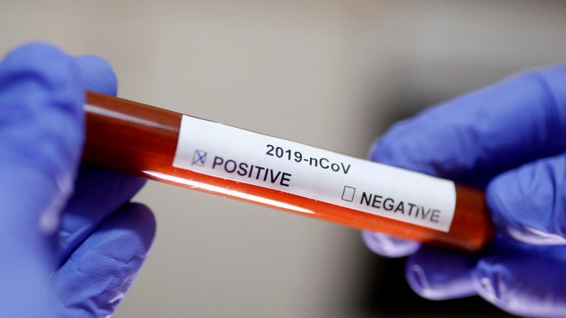 За прошедшие сутки в Казахстане выявлены 726 заболевших коронавирусом