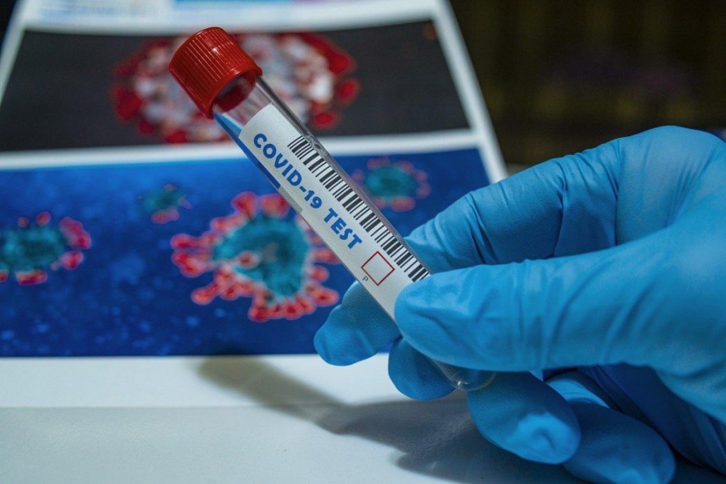 Более 300 тысяч случаев заболевания коронавирусом зарегистрировано в Казахстане
