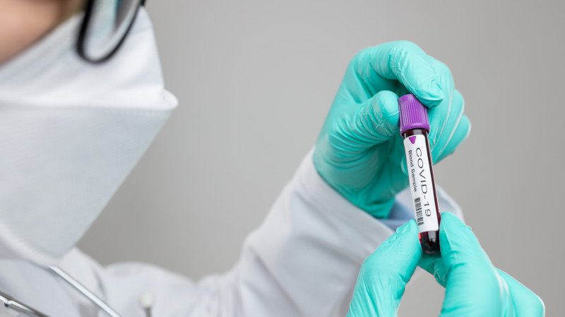 За прошедшие сутки зарегистрировано 7769 новых случаев заболевания коронавирусной инфекцией