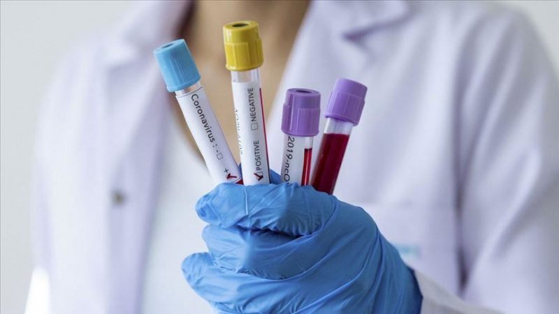За прошедшие сутки в Казахстане зарегистрировано 1707 новых случаев заболевания коронавирусной инфекцией