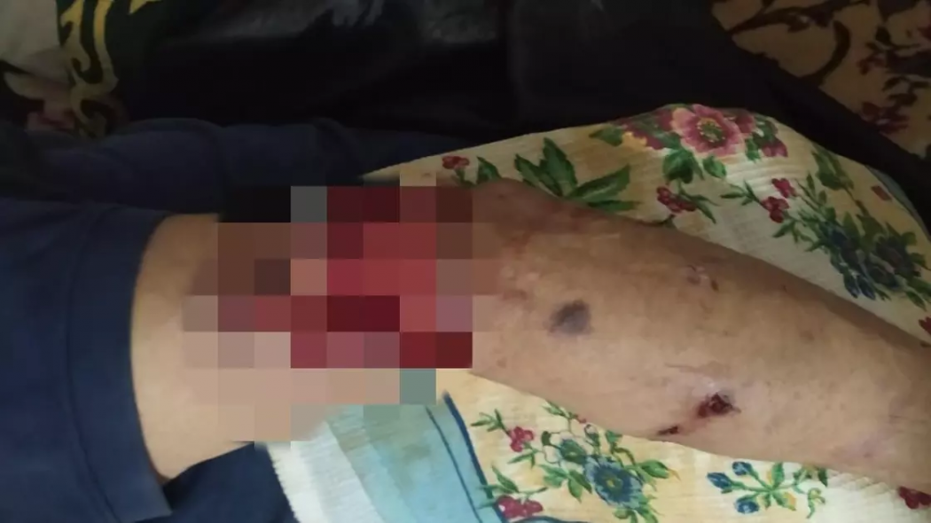 Собака разорвала руку мужчине в Павлодарской области