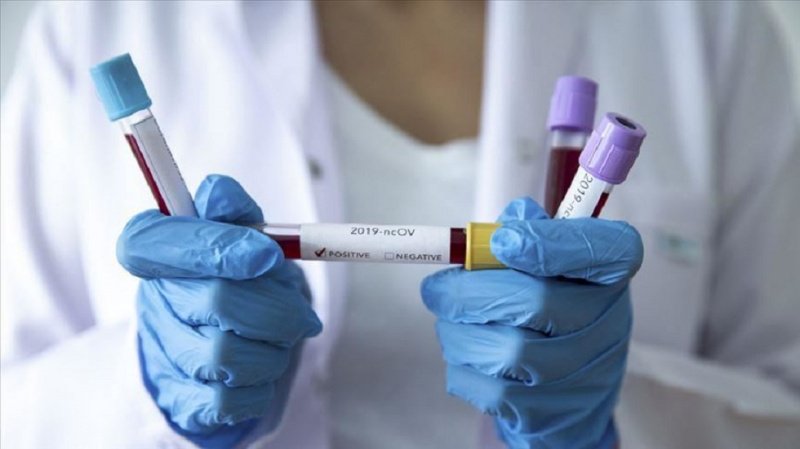 За прошедшие сутки в Казахстане зарегистрировано 5 466 новых случаев заболевания коронавирусной инфекцией