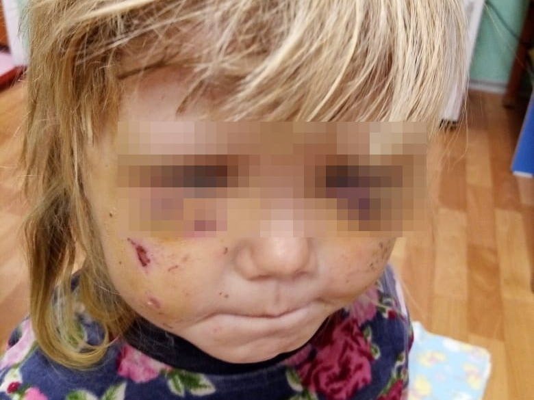 Избитых пьяным братом девочек-маугли нашли в Усть-Каменогорске 