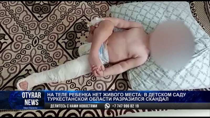 Ребенок получил переломы в детсаду: в ДП Туркестанской области рассказали подробности 